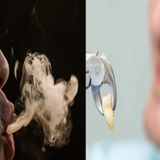 can i vape after a tooth extraction